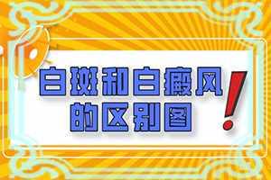 得了白斑病怎么治疗吃什么好[怎么治疗这几点要记住]皮肤病怎么治