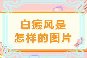 身上为什么起白斑-身白斑是什么原因-因为什么患上