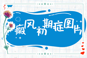 腿上白斑早期症状图片[得了后皮肤上有哪些表现]身上有白块是什么