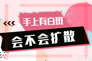 白癫风用什么药最好[诊疗白斑这些是关键]白癞风初期能治好吗